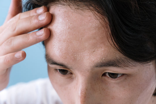 Getting Rid of Crepey Skin | Exclusive Guide