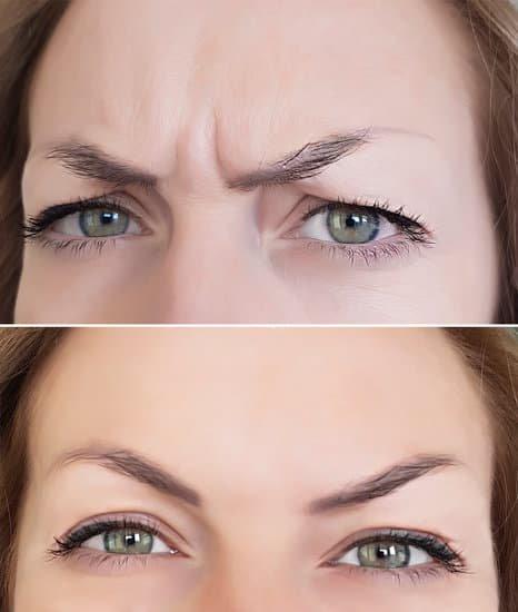Pore Minimizing Benefits -Without- the Mistakes